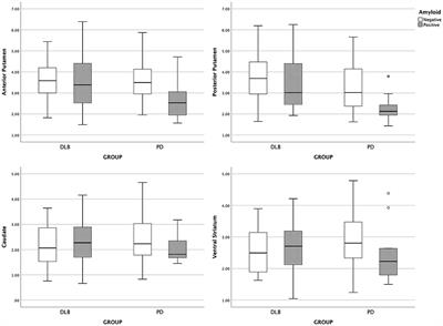 Distinct amyloid-dependent patterns of nigra dopamine depletion in Lewy body diseases